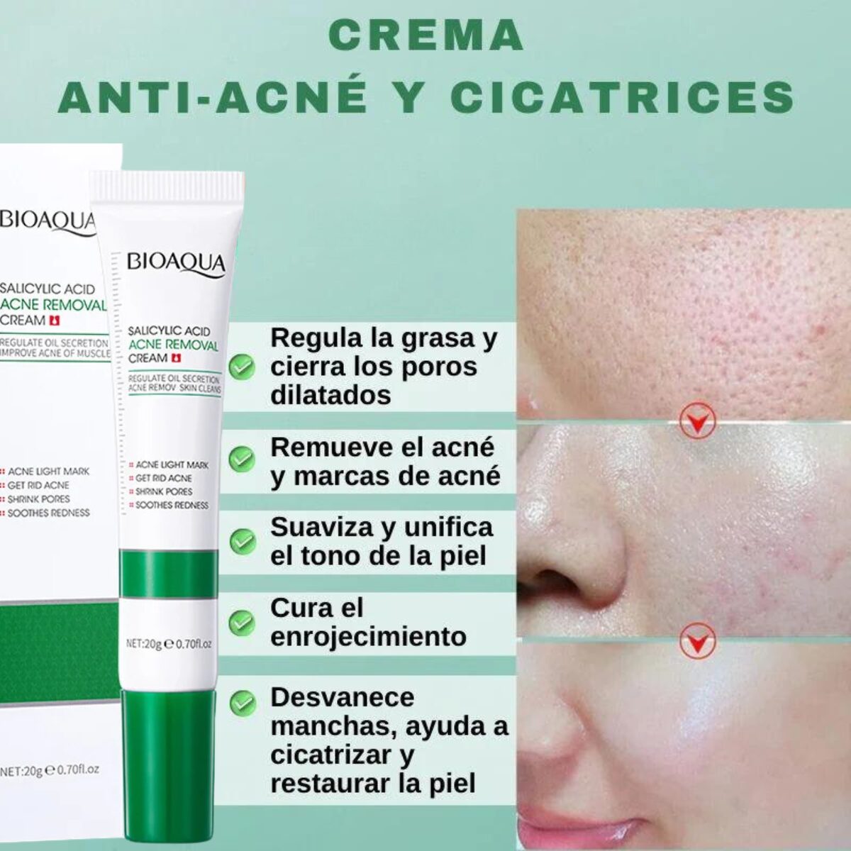 CREMA ANTIACNÉ DE ÁCIDO SALICILICO BIOAQUA - Centrika Market